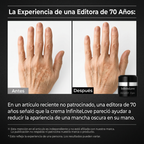 Crema Despigmentante Intensiva – Reduce Manchas y Unifica el Tono