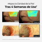 Crema Despigmentante Intensiva – Reduce Manchas y Unifica el Tono