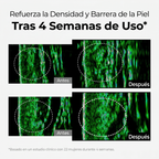 Crema Despigmentante Intensiva – Reduce Manchas y Unifica el Tono