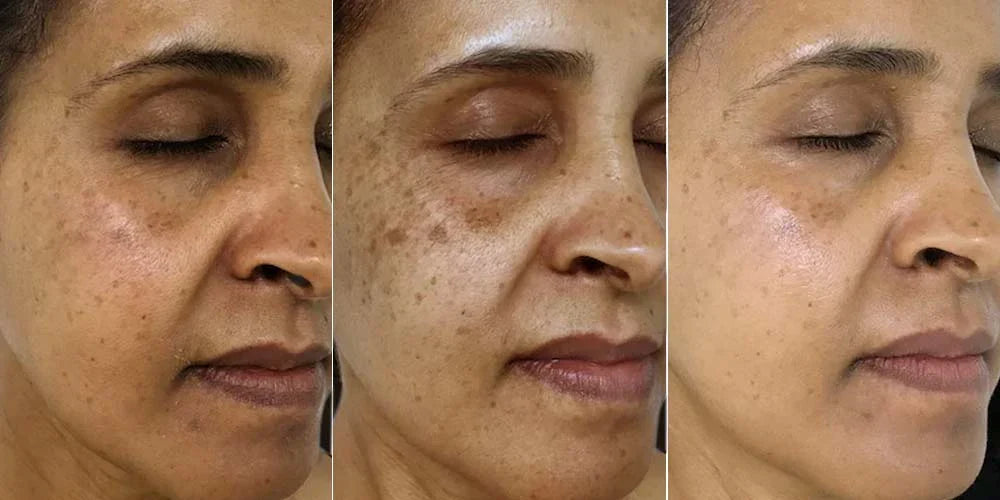 Corrector de Manchas Oscuras con Vitamina C – Rostro y Manos