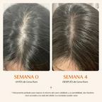 Suero Estimulador de Crecimiento Capilar con Cepillo Masajeador Integrado para Frenar la Caída y Engrosar el Cabello