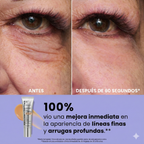 InfiniteLift - Gel tensor rejuvenecedor para tus ojos