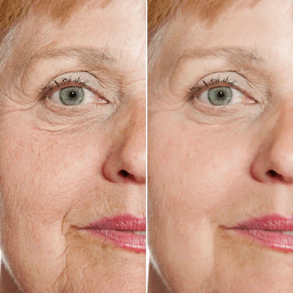 Suero Facial Rejuvenecedor