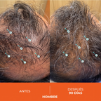 Shampoo Estimulante Capilar de Alto Rendimiento 205ml