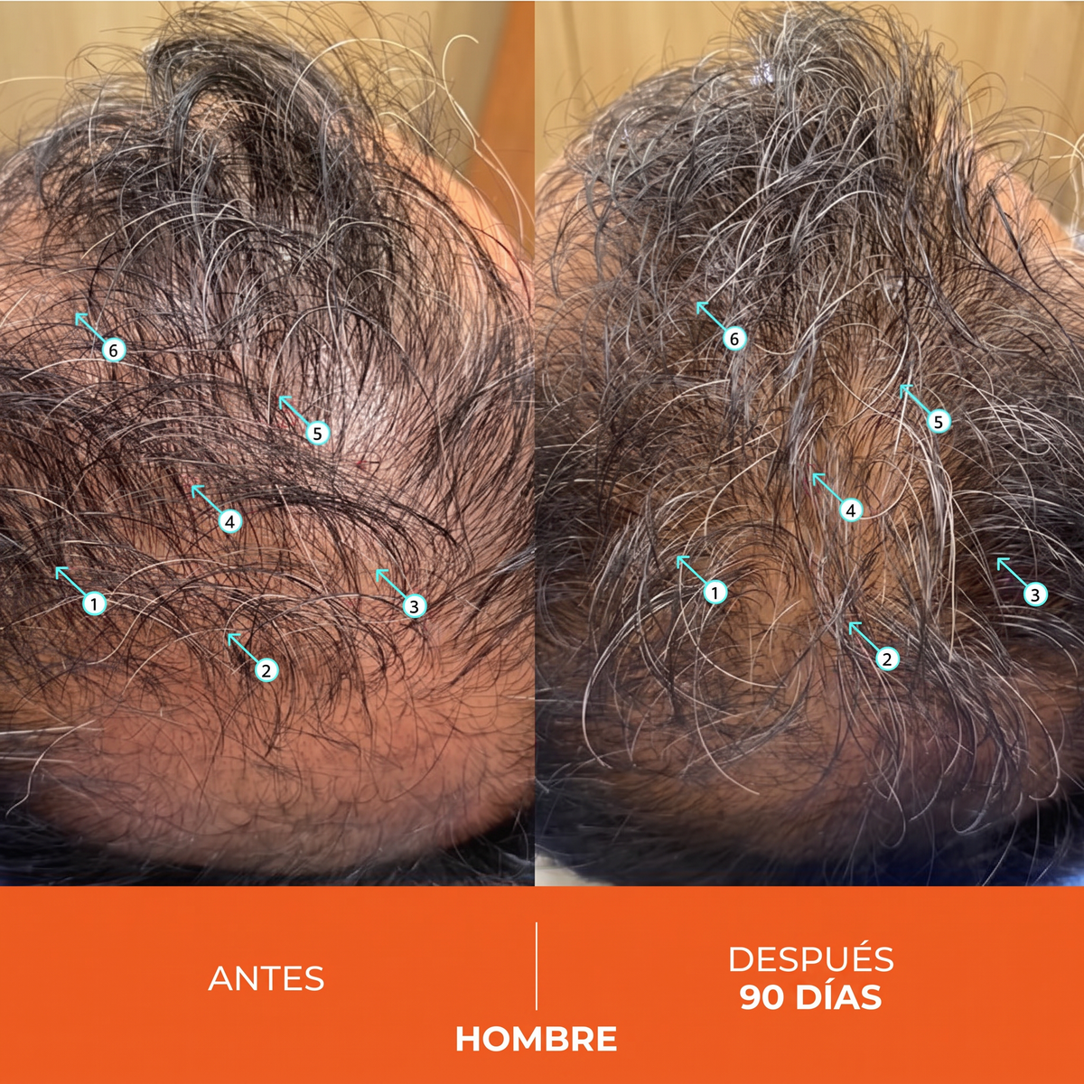 Shampoo Estimulante Capilar de Alto Rendimiento 205ml