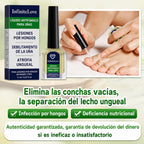 Líquido Antifúngico Uñas Tolnaftato 1% Tratamiento Hongos Manos y Pies 11ml