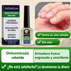 Líquido Antifúngico Uñas Tolnaftato 1% Tratamiento Hongos Manos y Pies 11ml