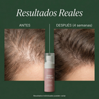 Spray Capilar Anticaída con Biotina y Cafeína – Fortalece y Reduce la Caída