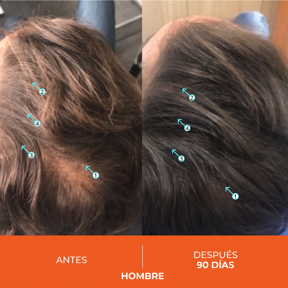 Shampoo Estimulante Capilar de Alto Rendimiento 205ml