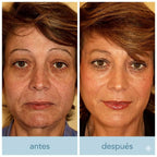 Solución Líquida — Sérum Facial Antiedad de Efecto Tensor