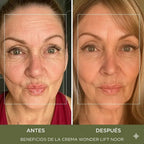 Crema Antiarrugas 'Efecto Botox' Wonder Lift con Péptidos Syn-Ake™ (Resultados en 4 Días)