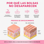 InfiniteEyes® — Terapia de Luz Roja + EMS para Eliminar Bolsas